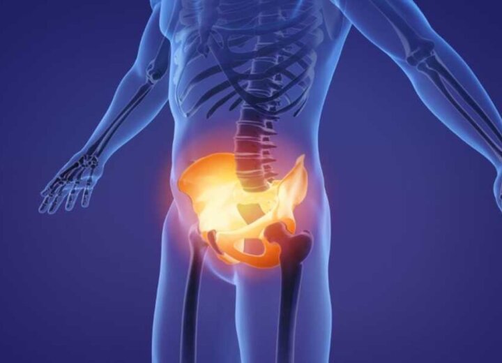 Лечение варикоцеле как шаг к сохранению мужского здоровья